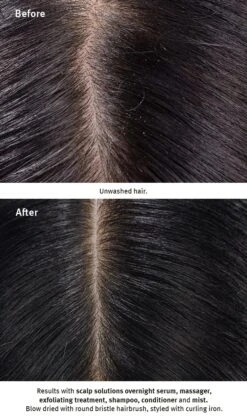 Aveda Scalp Solutions Replenishing Conditioner 14 Aveda Scalp Solutions Replenishing Conditioner -Aveda Store av prod 112259 355x600 5